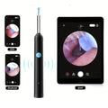 Earwax Cleaner With Camera & WiFi – HD Otoscope (Multicolor)