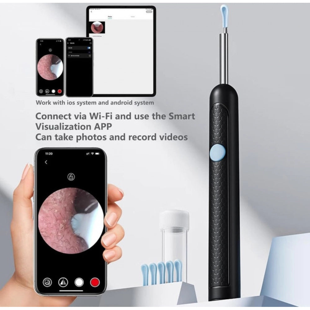 Earwax Cleaner With Camera & WiFi – HD Otoscope (Multicolor)